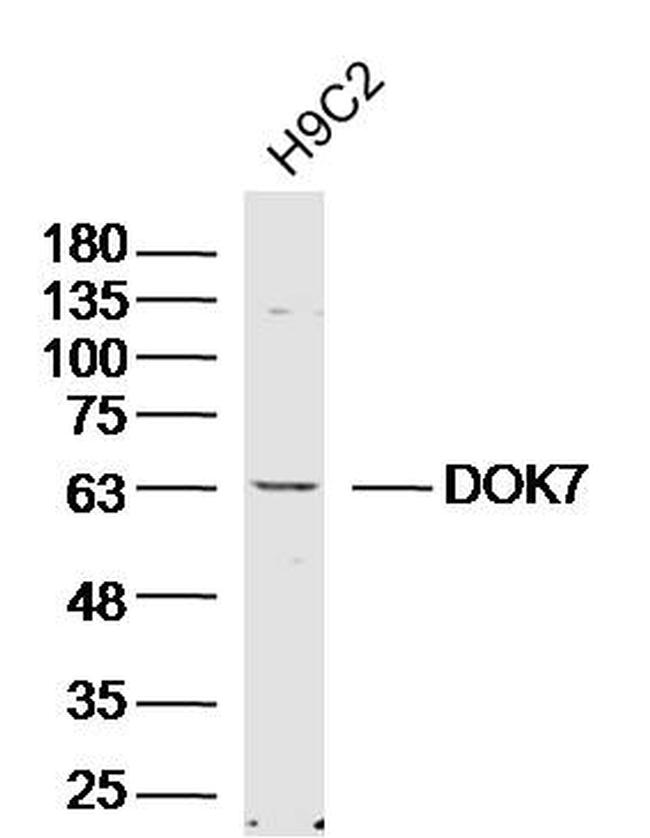 DOK7 Antibody in Western Blot (WB)