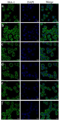 AIF1 Antibody in Immunocytochemistry (ICC/IF)