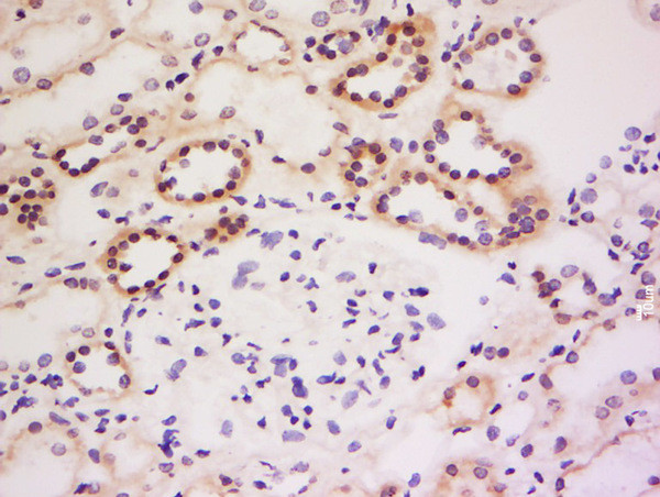 GRB 14 Antibody in Immunohistochemistry (Paraffin) (IHC (P))