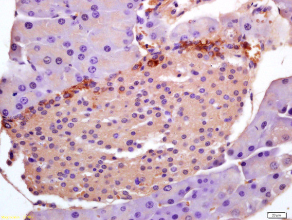 PHLDA1/TDAG51 Antibody in Immunohistochemistry (Paraffin) (IHC (P))