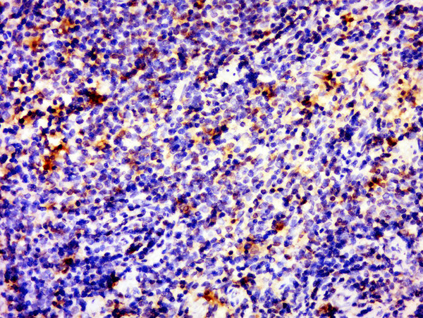 SLAP2 Antibody in Immunohistochemistry (Paraffin) (IHC (P))