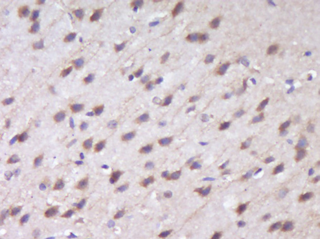 RUSC1 Antibody in Immunohistochemistry (Paraffin) (IHC (P))