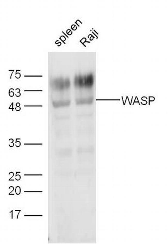 WASP Antibody in Western Blot (WB)