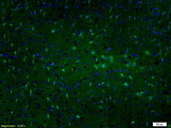 MAP2/MAP-2a.b.c Polyclonal Antibody (BS-1369R)