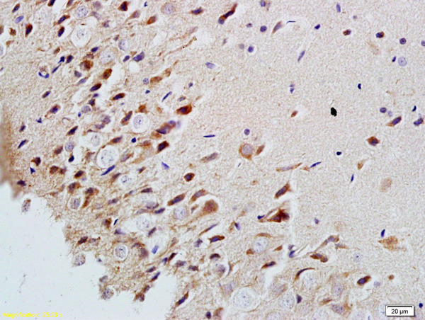MAP2/MAP-2a.b.c Antibody in Immunohistochemistry (Paraffin) (IHC (P))