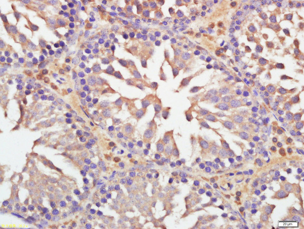 DNAAF3 Antibody in Immunohistochemistry (Paraffin) (IHC (P))