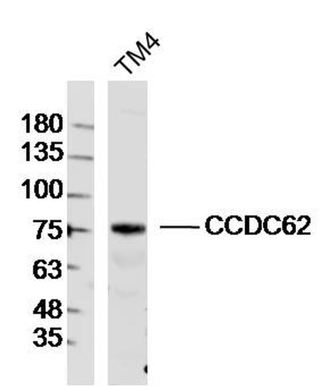 CCDC62 Antibody in Western Blot (WB)