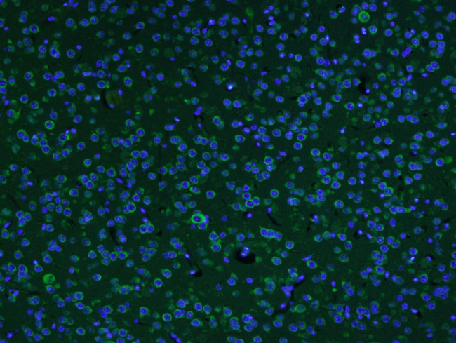 AKAP12/Gravin Antibody in Immunohistochemistry (Paraffin) (IHC (P))