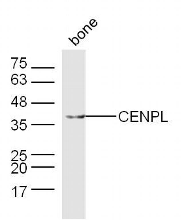 CENPL Antibody in Western Blot (WB)