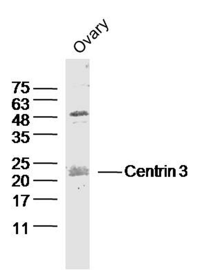 Centrin 3 Antibody in Western Blot (WB)