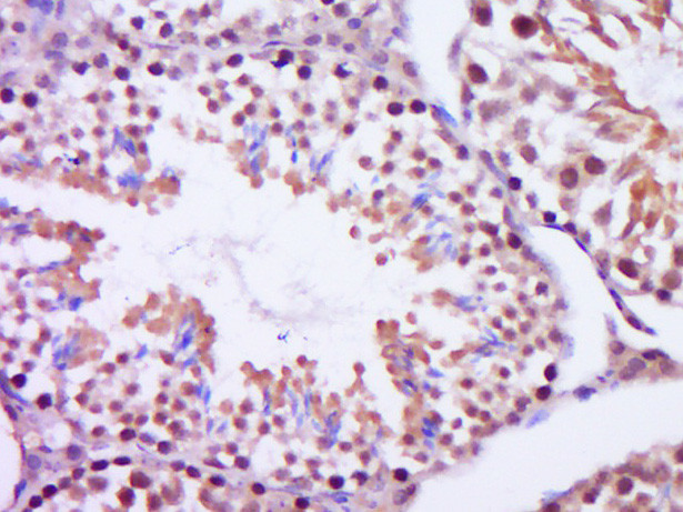 Centrin 2 Antibody in Immunohistochemistry (Paraffin) (IHC (P))