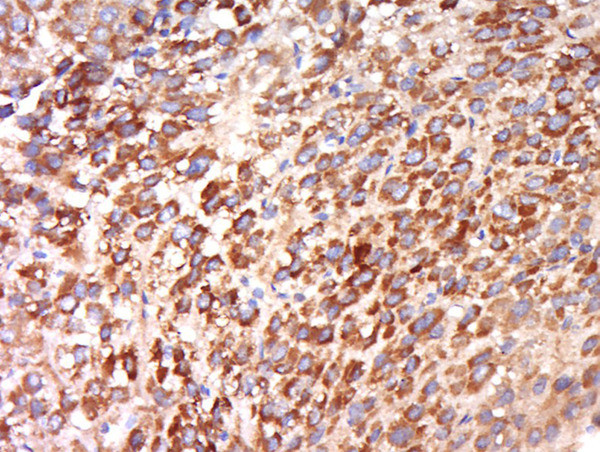 CEP192 Antibody in Immunohistochemistry (Paraffin) (IHC (P))