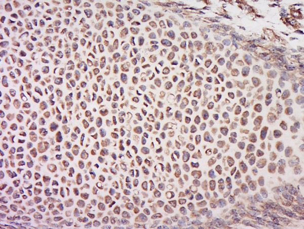CEP70 Antibody in Immunohistochemistry (Paraffin) (IHC (P))