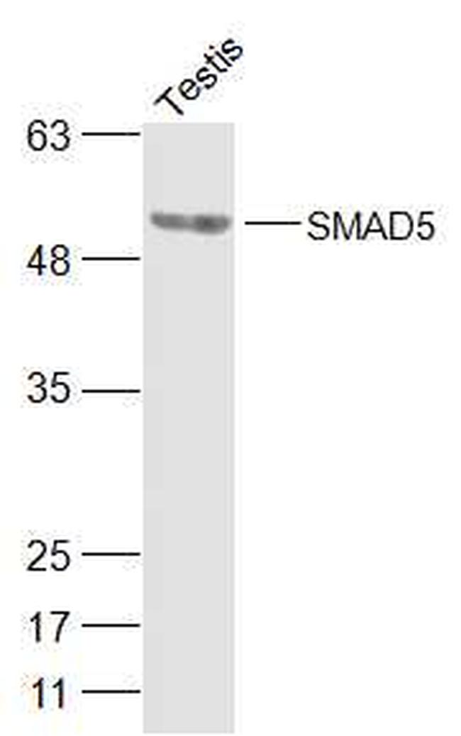 SMAD5 Antibody in Western Blot (WB)