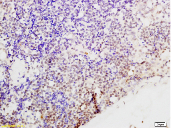 Cyclin G Antibody in Immunohistochemistry (Paraffin) (IHC (P))