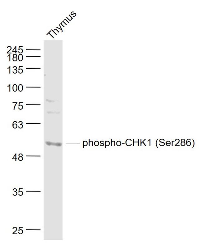 Phospho-CHK1 (Ser286) Antibody in Western Blot (WB)