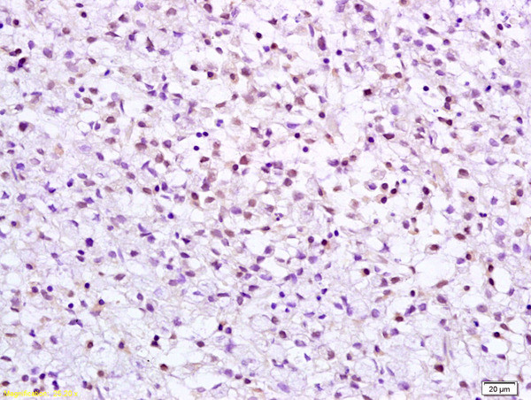 CHK2 Antibody in Immunohistochemistry (Paraffin) (IHC (P))
