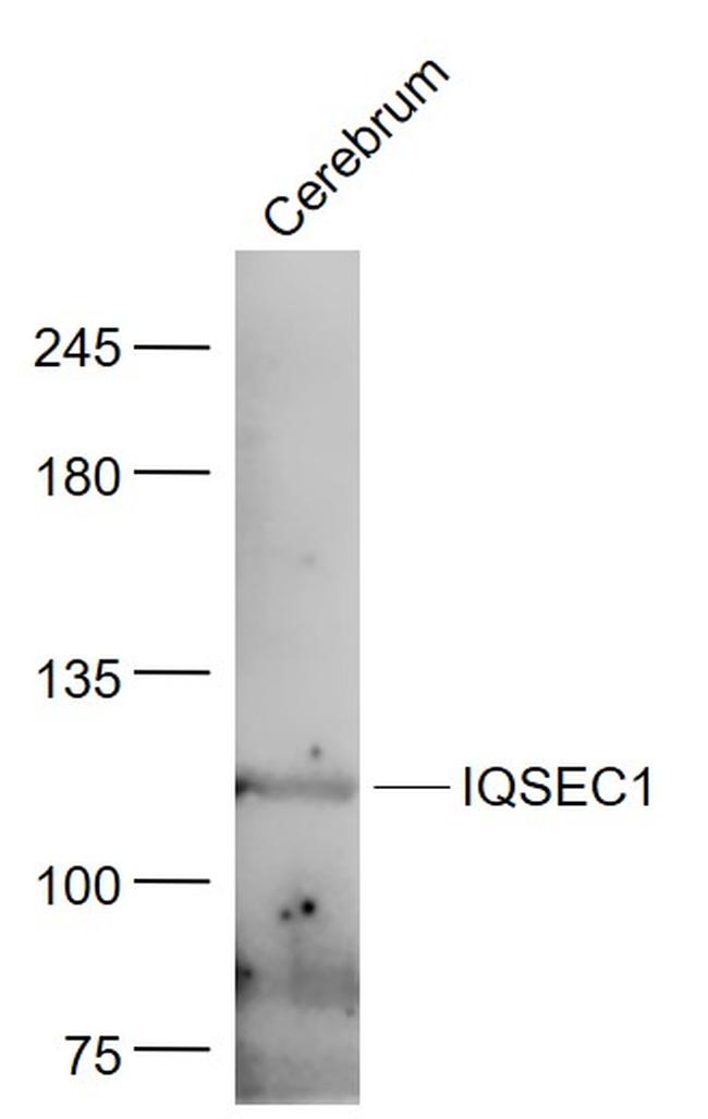 GEP100/IQSEC1 Antibody in Western Blot (WB)