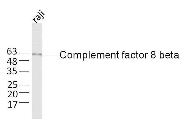 Complement factor 8 beta Antibody in Western Blot (WB)