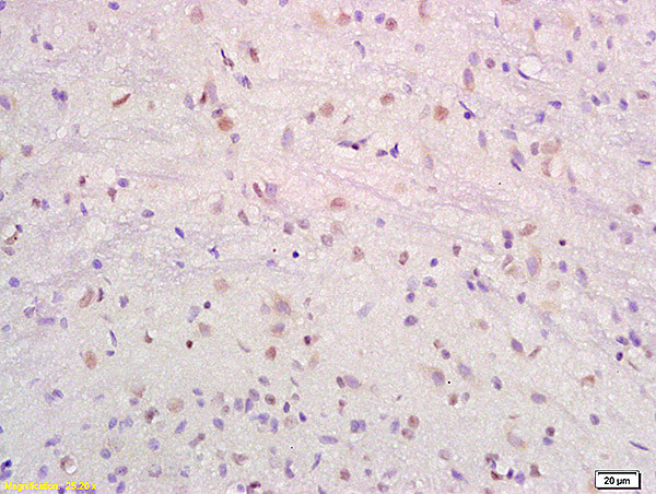 SRF Antibody in Immunohistochemistry (Paraffin) (IHC (P))