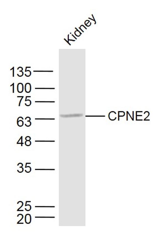 CPNE2 Antibody in Western Blot (WB)