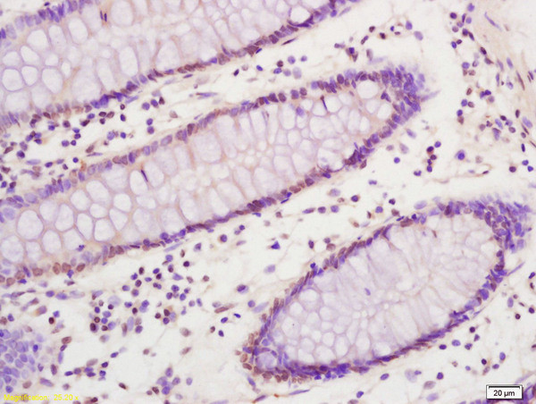 SREBP-1/2 Antibody in Immunohistochemistry (Paraffin) (IHC (P))