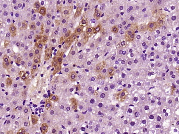 CPS1 Antibody in Immunohistochemistry (Paraffin) (IHC (P))
