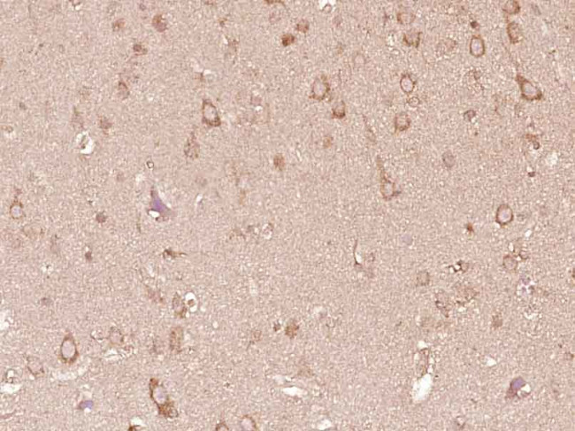 CRB1 Antibody in Immunohistochemistry (Paraffin) (IHC (P))