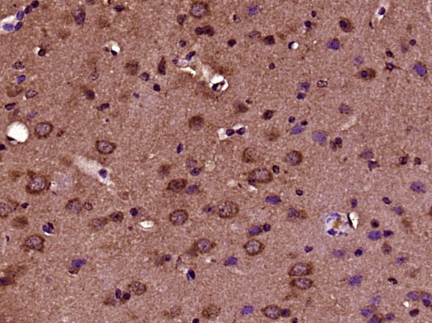 CRB2 Antibody in Immunohistochemistry (Paraffin) (IHC (P))