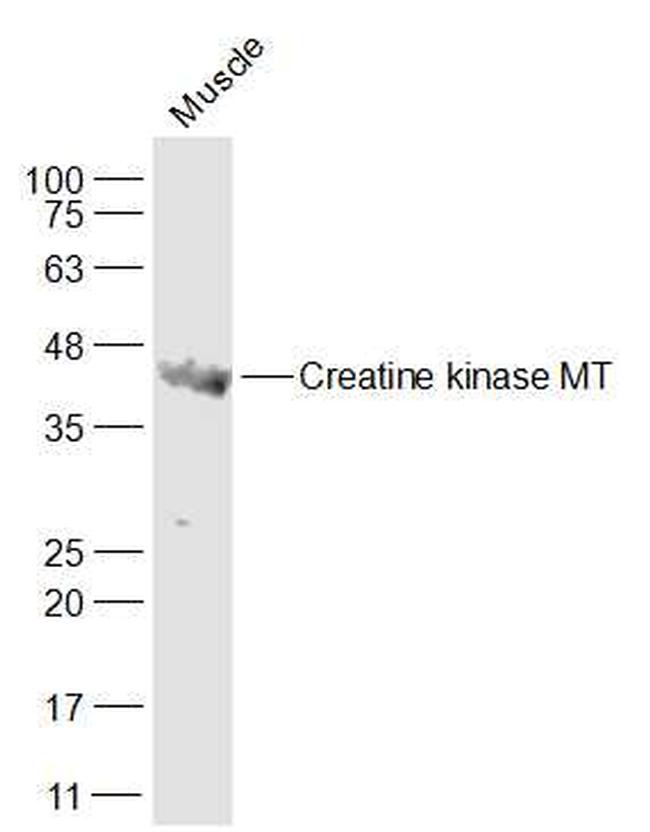 CKMT1A/B + CKMT2 + CKB + CKM Antibody in Western Blot (WB)