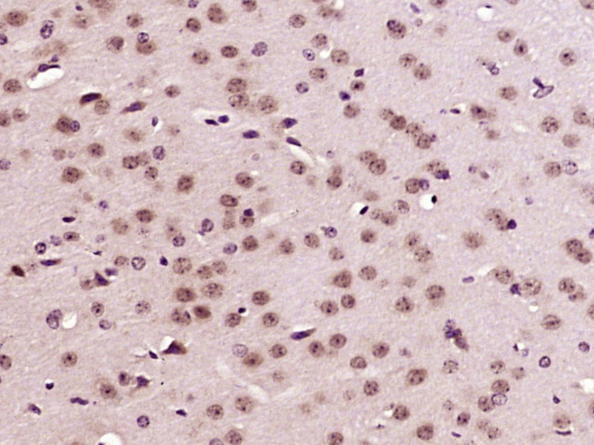 CREB5 Antibody in Immunohistochemistry (Paraffin) (IHC (P))