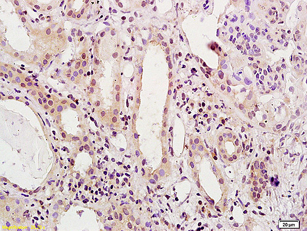 HNF1A Antibody in Immunohistochemistry (Paraffin) (IHC (P))