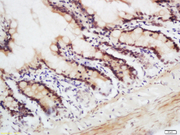 CRNKL1 Antibody in Immunohistochemistry (Paraffin) (IHC (P))
