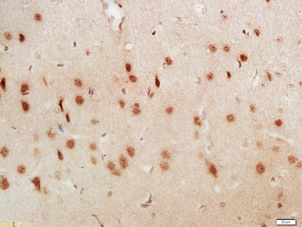 LUC7L3 Antibody in Immunohistochemistry (Paraffin) (IHC (P))