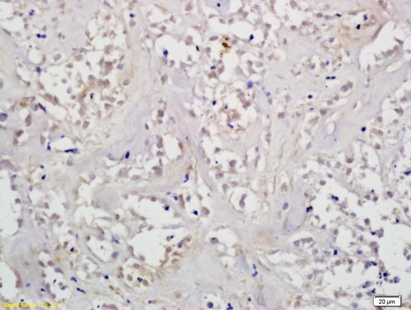 H-1 beta Antibody in Immunohistochemistry (Paraffin) (IHC (P))