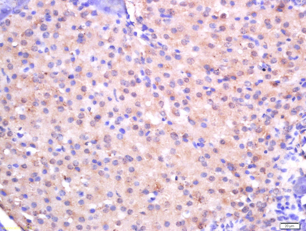 CTDSP2 Antibody in Immunohistochemistry (Paraffin) (IHC (P))