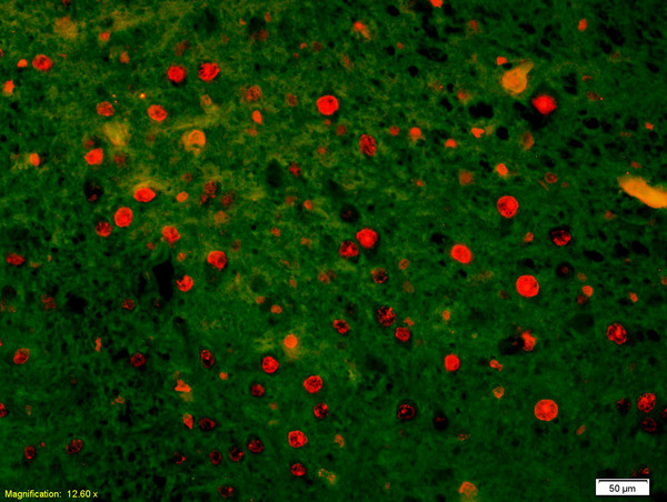 HSTF2 Antibody in Immunohistochemistry (Paraffin) (IHC (P))