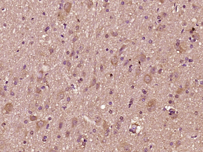 CTTNBP2 Antibody in Immunohistochemistry (Paraffin) (IHC (P))
