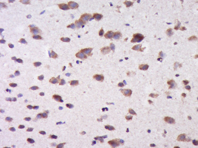 CTTNBP2NL Antibody in Immunohistochemistry (Paraffin) (IHC (P))