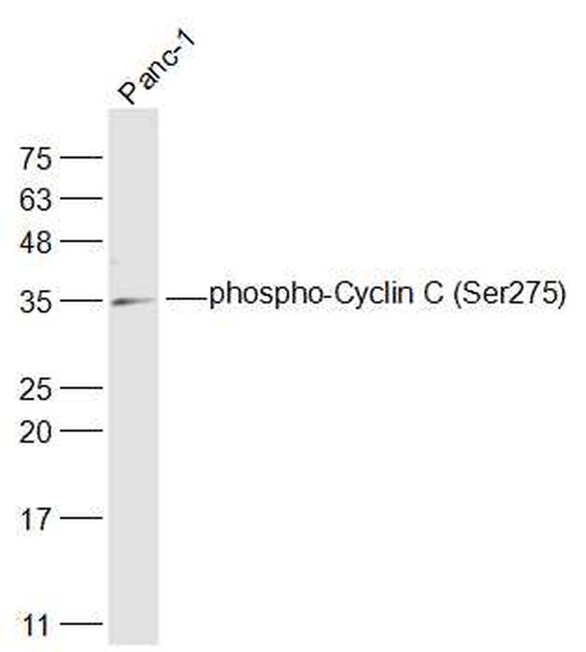 Phospho-Cyclin C (Ser275) Antibody in Western Blot (WB)