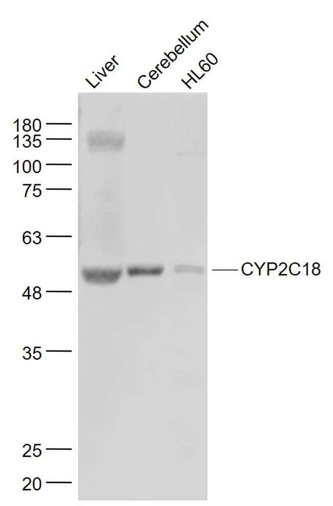 CYP2C18 Antibody in Western Blot (WB)