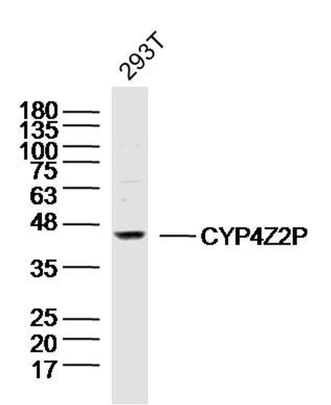 CYP4Z2P Antibody in Western Blot (WB)