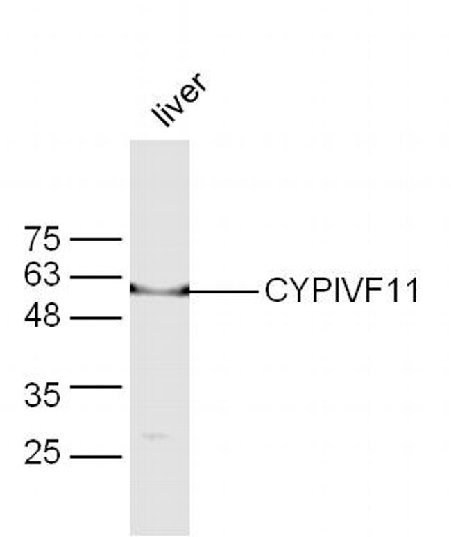 CYPIVF11 Antibody in Western Blot (WB)