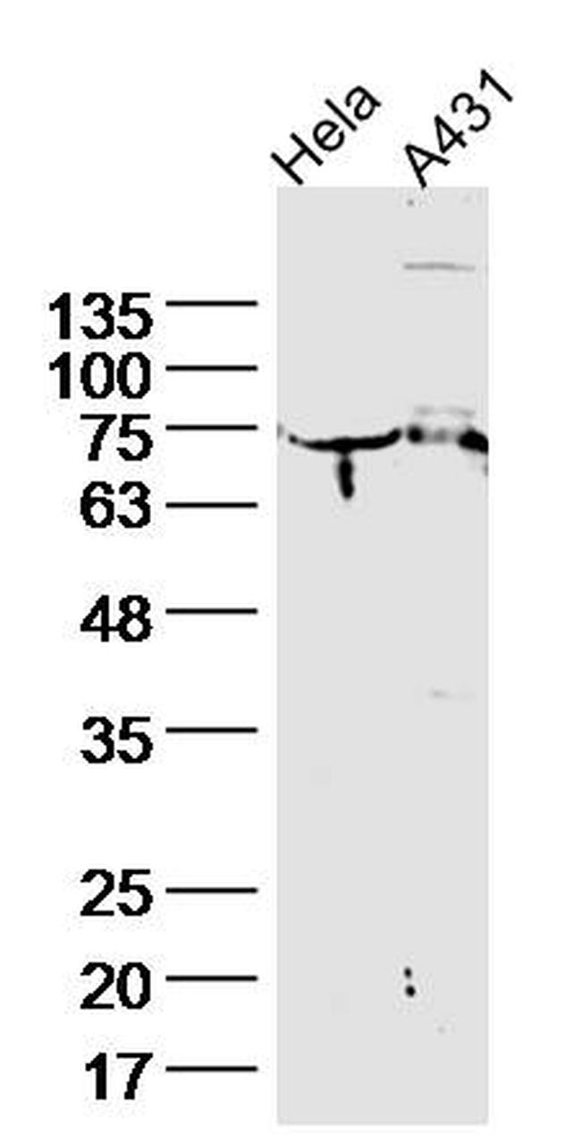 Cytokeratin 2e Antibody in Western Blot (WB)