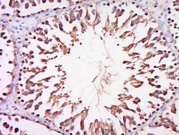 DARS2 Antibody in Immunohistochemistry (Paraffin) (IHC (P))