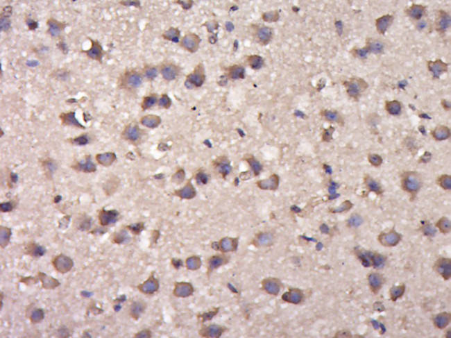 Phospho-delta 1 Catenin (Tyr280) Antibody in Immunohistochemistry (Paraffin) (IHC (P))