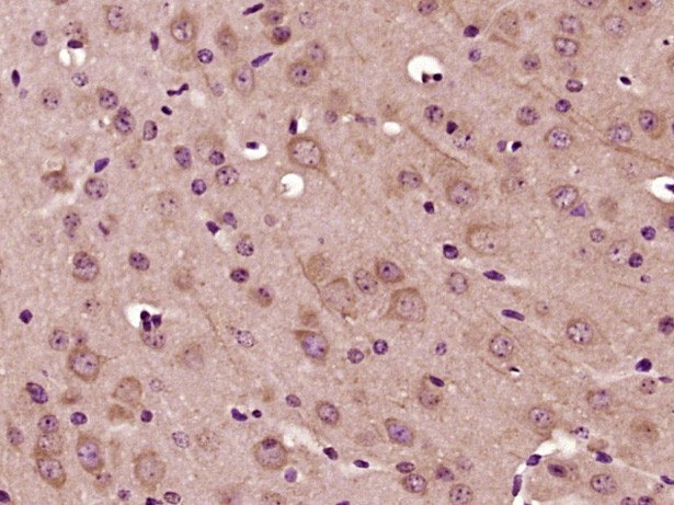 MADD Antibody in Immunohistochemistry (Paraffin) (IHC (P))