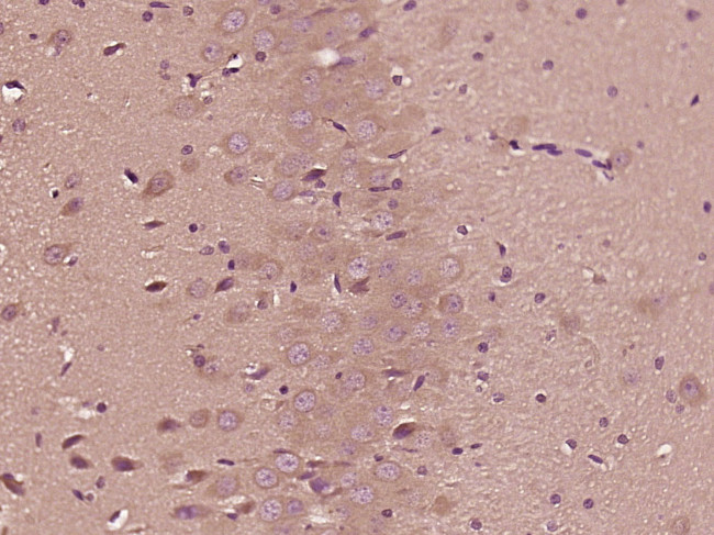 DENND1A Antibody in Immunohistochemistry (Paraffin) (IHC (P))