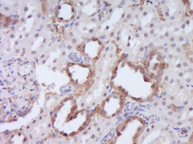 DENND4B Antibody in Immunohistochemistry (Paraffin) (IHC (P))