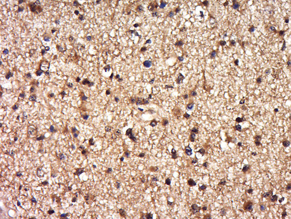 DEPDC1B Antibody in Immunohistochemistry (Paraffin) (IHC (P))